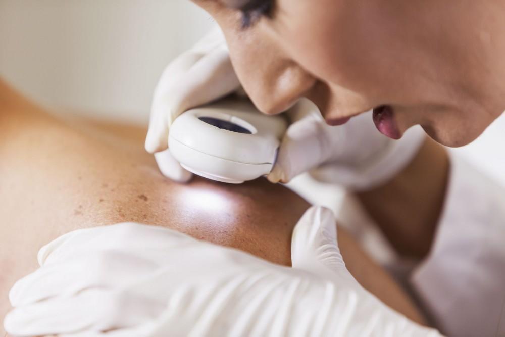 Dermatologist Kuwait – Your Guide to Healthy Skin