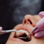 Lingual Braces Orthodontist Melbourne Eastern Suburbs for Adults