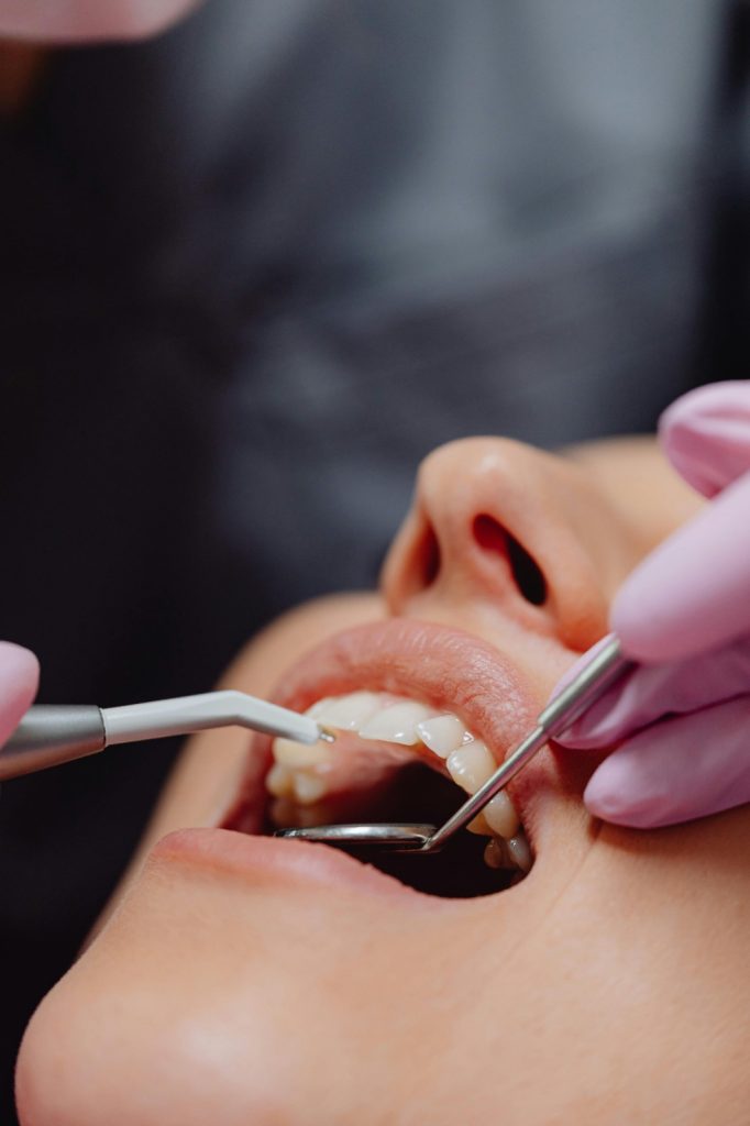 Lingual Braces Orthodontist Melbourne Eastern Suburbs for Adults